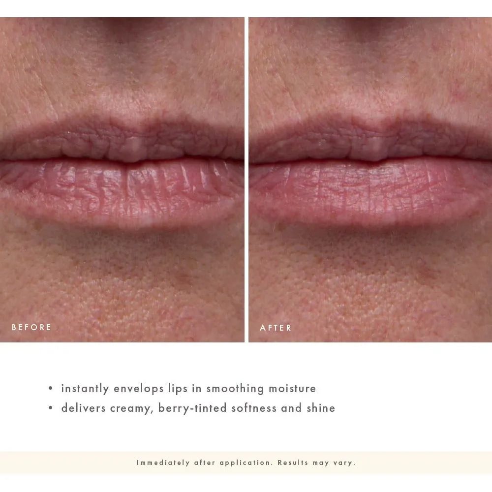 Blissedberry® Juicy Lip Therapy