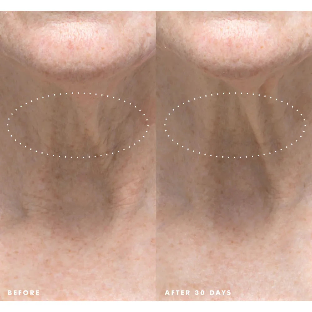 Necks-Level Smooth™ Ultra-Smoothing Triple Effect Neck Cream