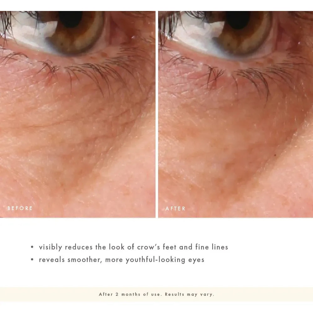 Crow Catcher® Eye Transforming Serum