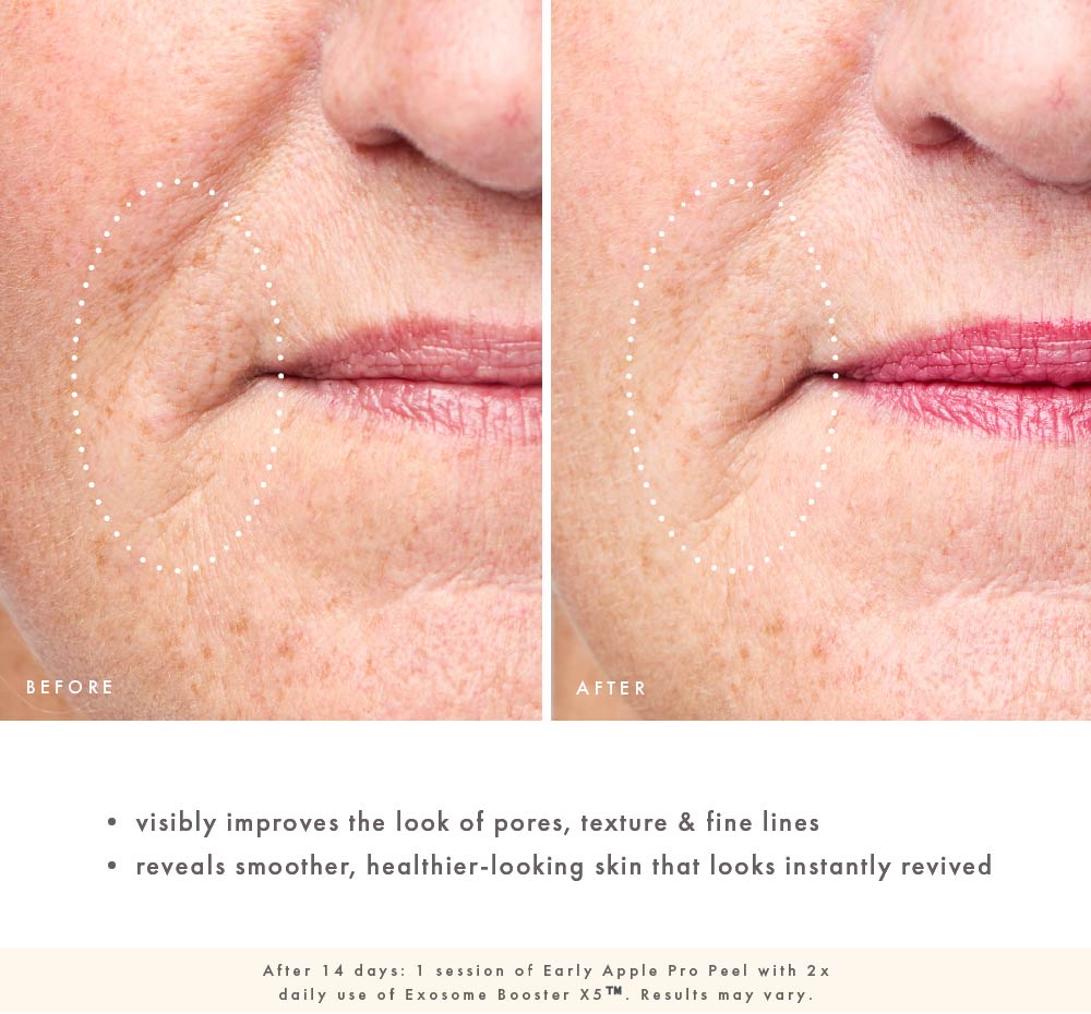 Exosome Booster  X5™ Advanced Renewal