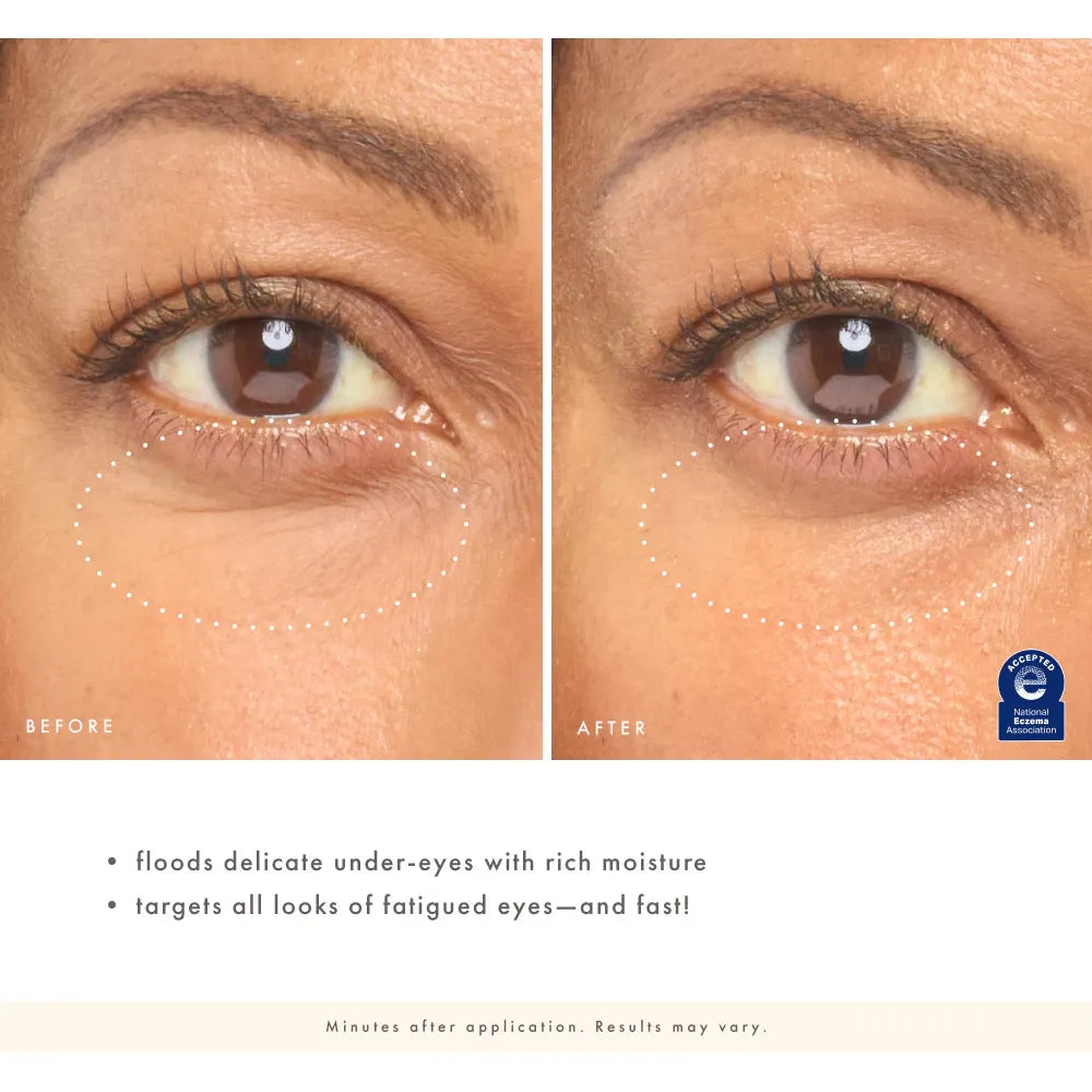 Eye'm Revived™ Total Renewal Cream
