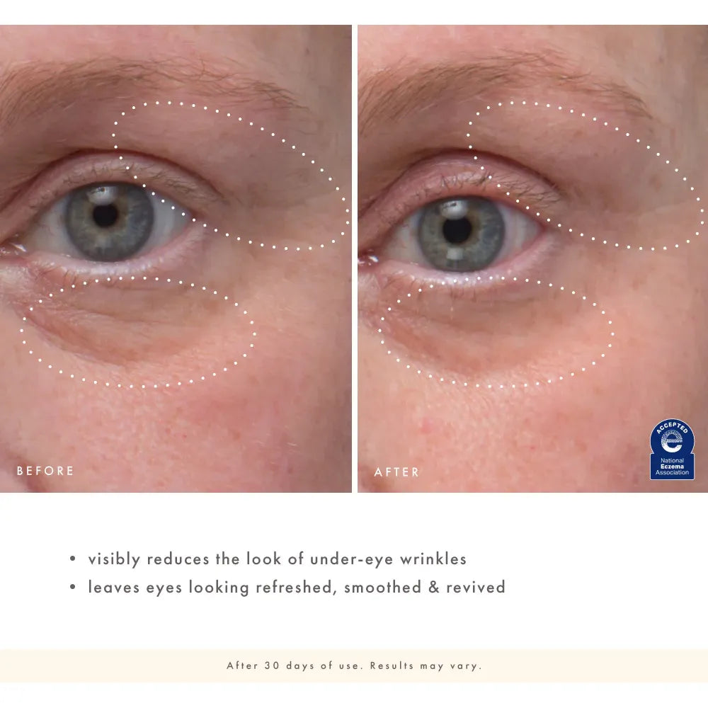 Eye'm Revived™ Total Renewal Cream