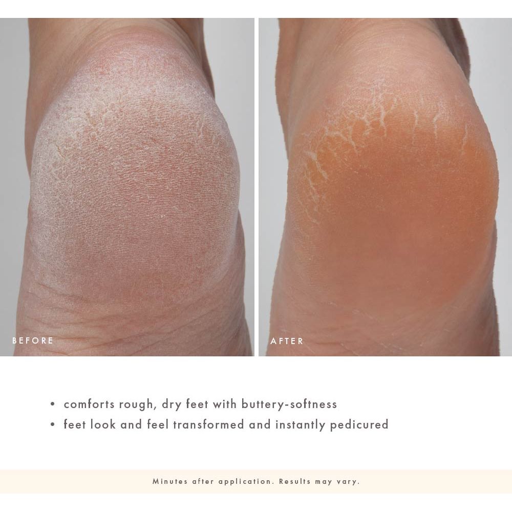 Enrich Mint® Foot Rescue Mask